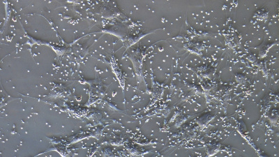Trzydniowa kohodowla limfocytów Treg (małe komórki) oraz MSC (duże komórki); w centrum widoczna jest komórka MSC, którą pokrywają limfocyty Treg